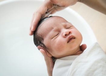 Bebeklerde saç dökülmesine ne iyi gelir? Bebeklerde saç dökülmesi nedenleri ve doğal çözümleri