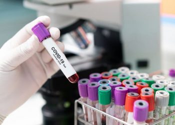 Kan grubu ve Covid 19 arasında nasıl bir ilişki var