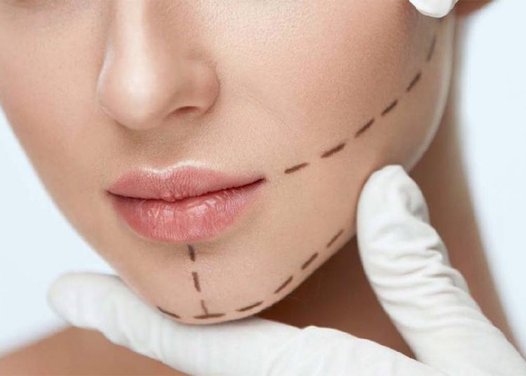 Dudak Çizgileri Nedir, Neden Olur ve Nasıl Önlenir?